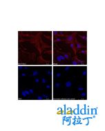 Goat Anti-Rabbit IgG H&L (TRITC)