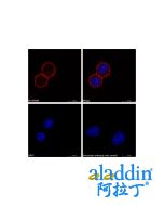 Goat Anti-Human IgG (TRITC)