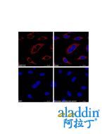 Goat Anti-Rabbit IgG H&L (TRITC)