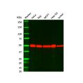 Recombinant PABPN1 Antibody