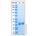 Recombinant Human Angiopoietin-like 4/ANGPTL4 Protein