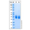 Recombinant Human B7-H6 Protein