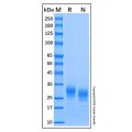 Recombinant Human Fc gamma RIIB/CD32b Protein