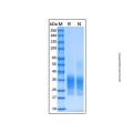 Recombinant Human CD79B Protein