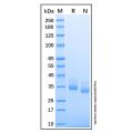 Recombinant Human Chymotrypsin C/CTRC Protein
