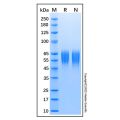 Recombinant Human Serpin A6 Protein
