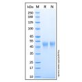 Recombinant Human CXCL16 Protein