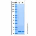 Recombinant Human Cystatin S Protein