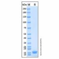 Recombinant Human Trappin-2/Elafin Protein