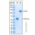Recombinant Human Frizzled-4 Protein