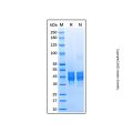 Recombinant Human Follistatin-like 1 Protein