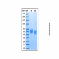 Recombinant Human IL1 Receptor I/IL-1R-1 Protein