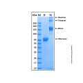 Recombinant Human IL-28 R alpha/IFN-lambda R1 Protein