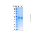 Recombinant Human IL-3RB Protein