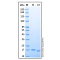 Recombinant Human Lipocalin-1 Protein