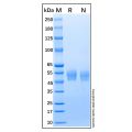 Recombinant Human Lumican Protein