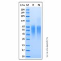 Recombinant Human C4.4A/LYPD3 Protein