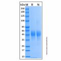 Recombinant Human MICB Protein