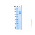 Recombinant Human OSMR beta Protein