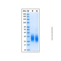 Recombinant Human PTH1R/PTHR1 Protein