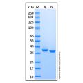 Recombinant Human Pepsinogen C/PGC Protein