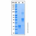 Recombinant Human PlGF Protein