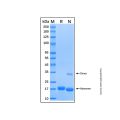 Recombinant Human Reg1B Protein