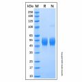 Recombinant Human Serpin B3/SSCA1 Protein