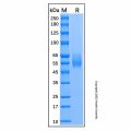 Recombinant Human Siglec-6/CD327 Protein