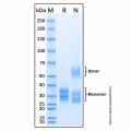 Recombinant Human Stanniocalcin 1/STC-1 Protein