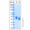 Recombinant Human TEM8/ANTXR1 Protein
