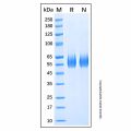 Recombinant Human Serpin A12 Protein