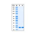 Recombinant Mouse IL-1 beta Protein