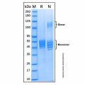 Recombinant Mouse IL-12/IL-23 p40 Monomer Protein