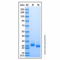 Recombinant Mouse Lipocalin-2/NGAL Protein