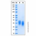 Recombinant Mouse Oncostatin M (OSM) Protein