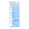 Recombinant Schistosoma japonicum GST Protein