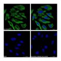 ICC/IF-Streptavidin protein (FITC) (rp155876)
ICC/IF with Streptavidin protein (FITC) (rp155876) stained HeLa cells. The cells were methanol fixed (5 min) and then incubated in 1% in 0.1% PBS-Tween for 1h to block non-specific protein-protein interaction