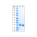 Recombinant Human SARS-CoV-2 Spike Protein RBD