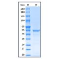 Recombinant Human Vimentin Protein