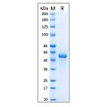 Recombinant Human GFAP Protein