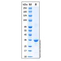 Recombinant Human Cyclin D1 Protein