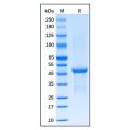 Recombinant Human FOXP3 Protein