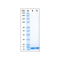 Recombinant Human LC3B Protein