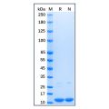 Recombinant Human Parvalbumin Protein