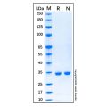 Recombinant Human Calponin 1 Protein