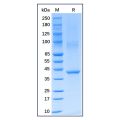 Recombinant Human Aurora B Protein