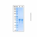 Recombinant Human VSIG4 Protein