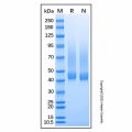 Recombinant Mouse Biglycan Protein