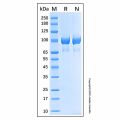 Recombinant Human Complement Component C2 Protein